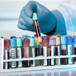 FDA схвалила аналіз крові для раннього виявлення колоректального раку